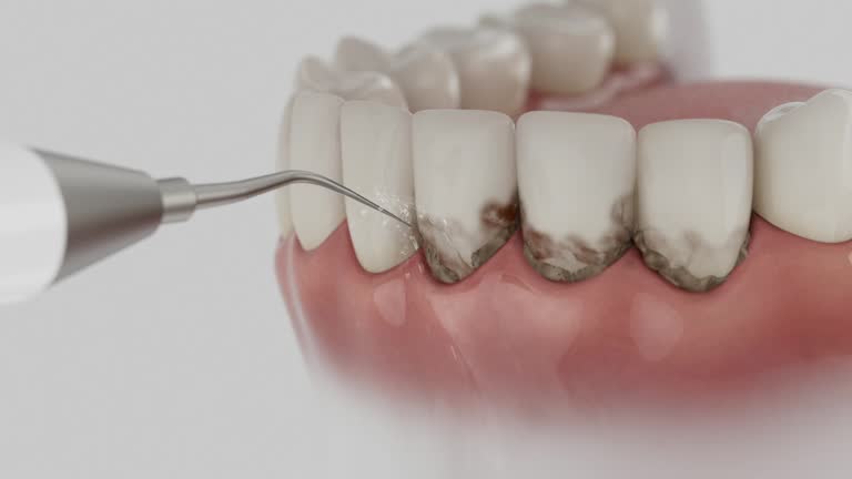Reliable Dental Implants contractor in Wallingford Center, CT by Smile Center Dentistry